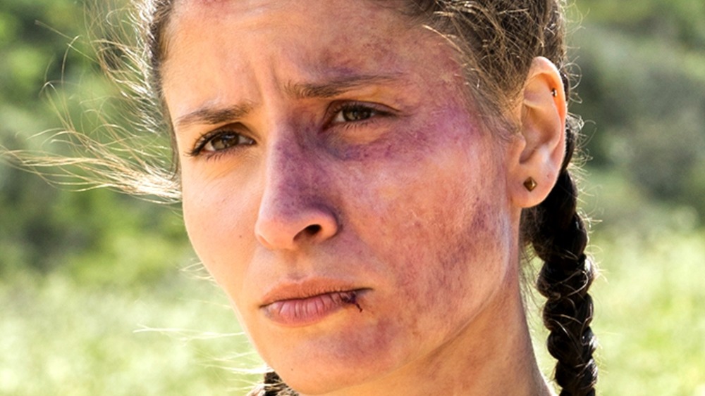 Ofelia with bruises on face
